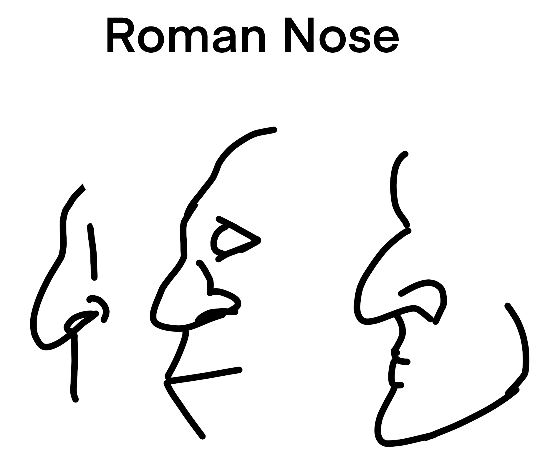 Roman Nose